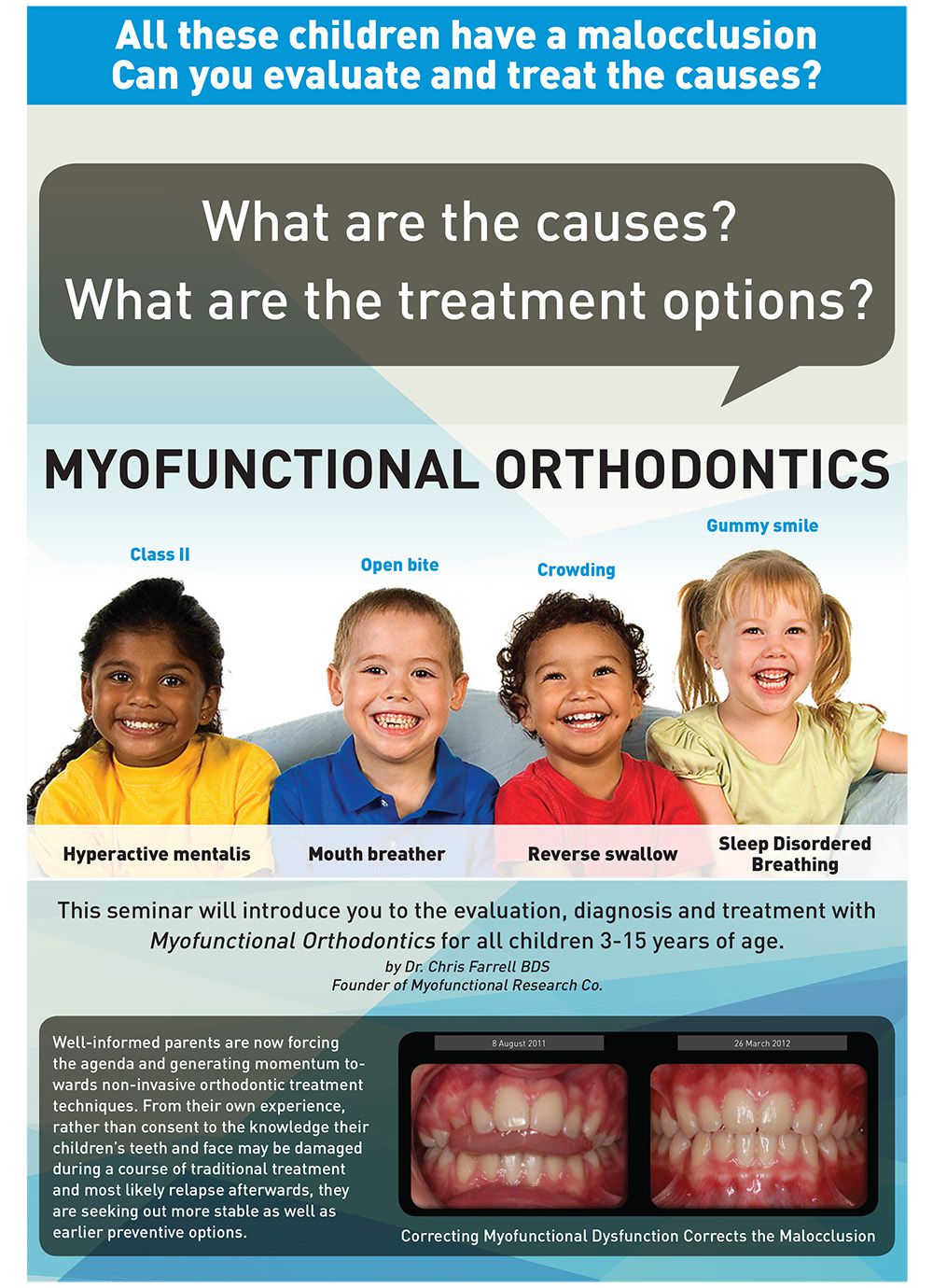 MYOFUNCTIONAL ORTHODONTICS - 2 DAY SEMINAR 20TH & 21ST AUGUST 2017 - KUALA LUMPUR